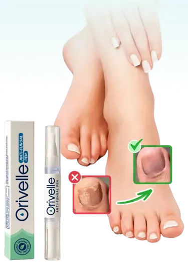 Orivelle Anti-Pilz-Stift